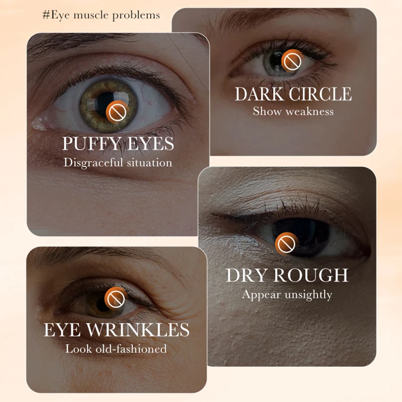 BIOAQUA Vitamin C Eye Cream Anti Dark Circles Remove Eye Bags Moisturizing Whitening Anti-aging Eyes Skin Care