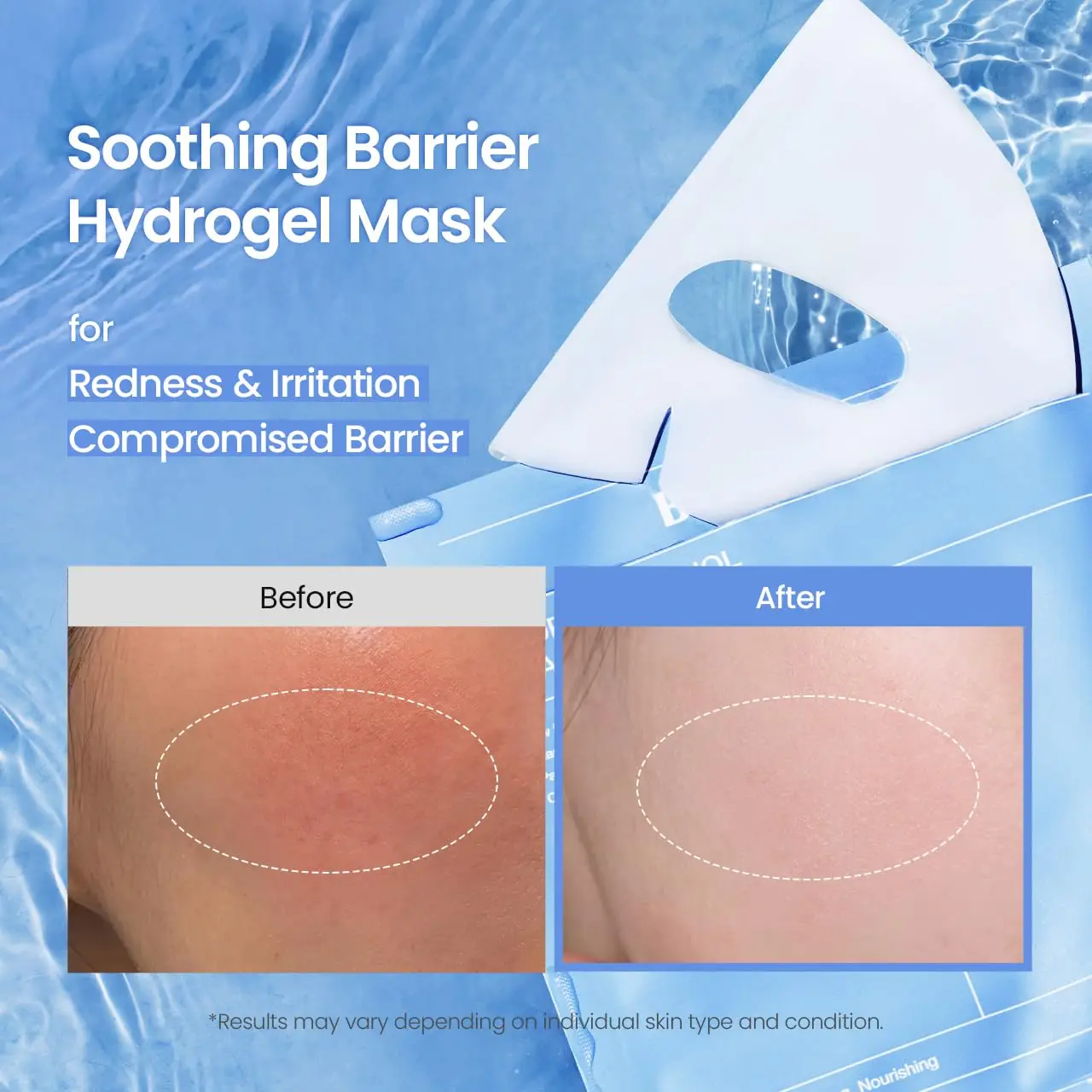 Hydrating Overnight Hydrogel Mask, Moisturizes, Reduces Redness, Soothes Skin, Korean Skincare Gift Set | 4 Sheets