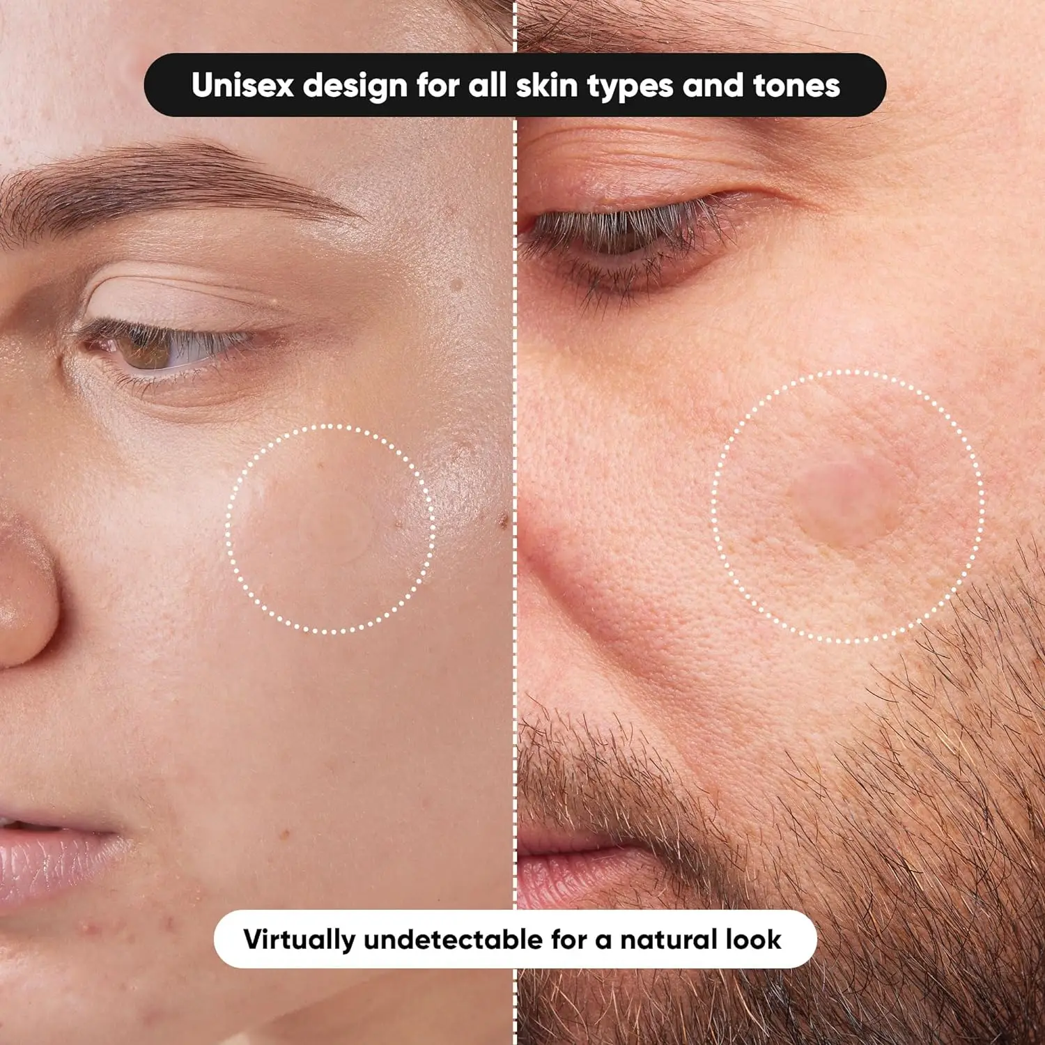 Invisible Waterproof Hydrocolloid Acne Patch for Facial Cleansing Care Essence Tool Accessory Suitable for All Skin Types