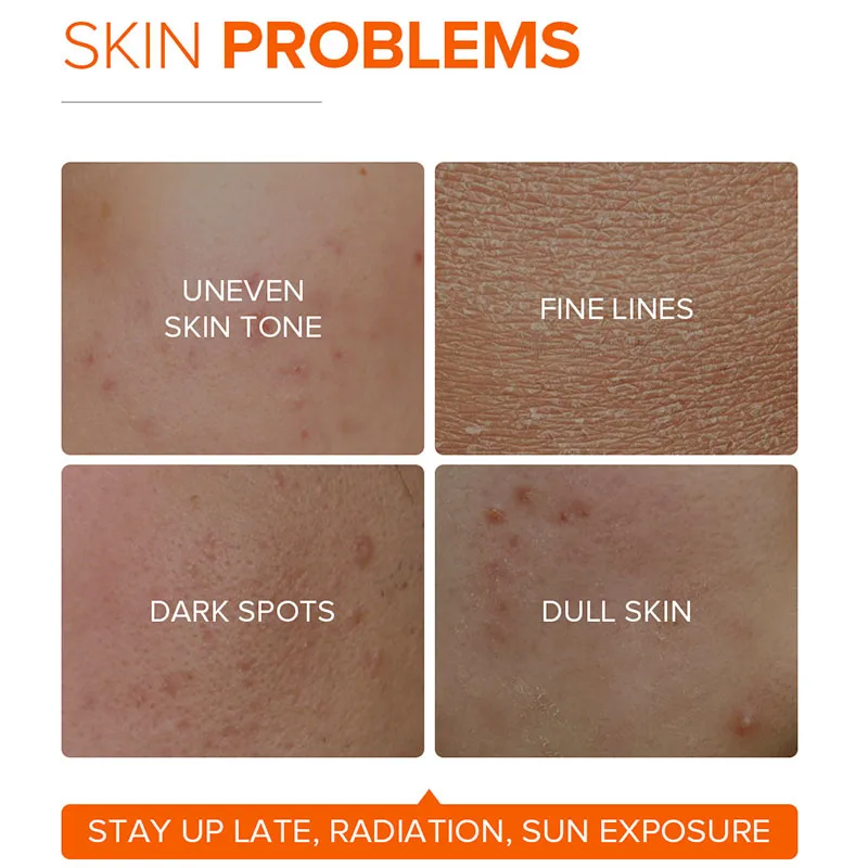 LAIKOU Vitamin C Facial Cream 50g Delicate Hydrating Moisturising Skin Care Products