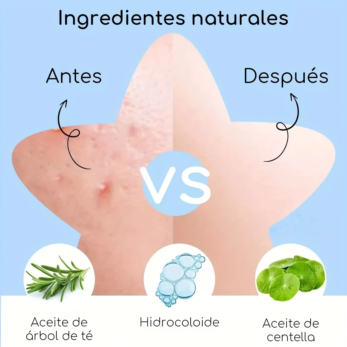 60-Piece Mirror-Boxed Star-Shaped Black Acne Patches – Hydrocolloid, Concealing, Lightweight and Pore-Cleansing