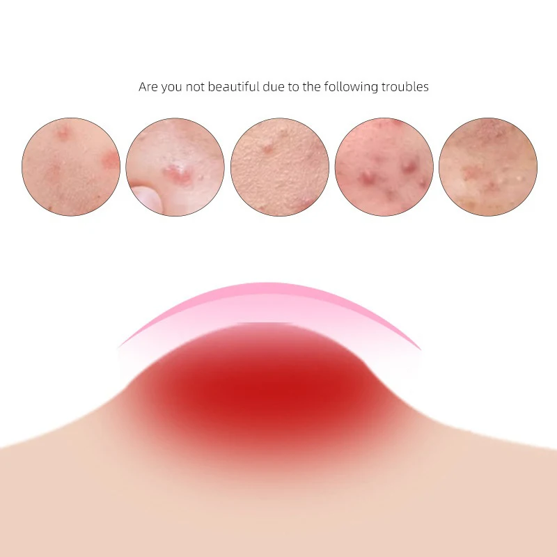 Color Cartoon Acne Patch Skin Care Sticker Concealer Facial Spot Beauty Makeup Tool