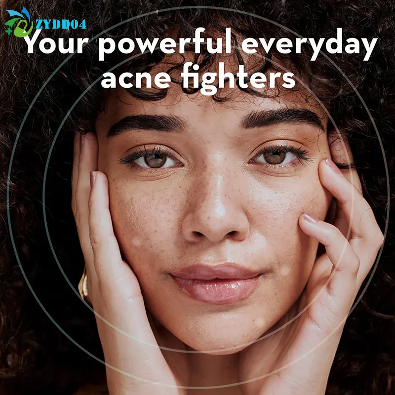 ●360pcs Pimple Patch Acne Invisible Acne Removal Skin Care Stickers Concealer Face Spot Beauty Makeup Tools