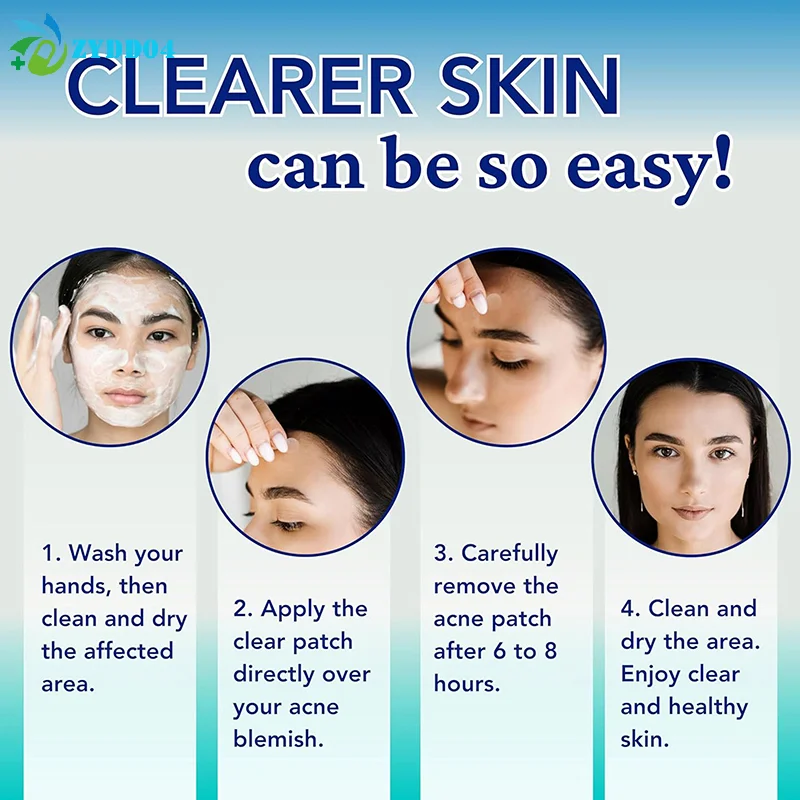 ●360pcs Pimple Patch Acne Invisible Acne Removal Skin Care Stickers Concealer Face Spot Beauty Makeup Tools