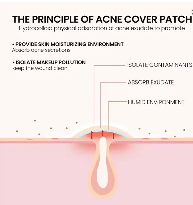 40pcs Star Pimple Patches For Face Hydrocolloid, Absorbing Cover, Tea Tree, Hydrocolloid Acne Patch, Cute Star Pimple Patch.