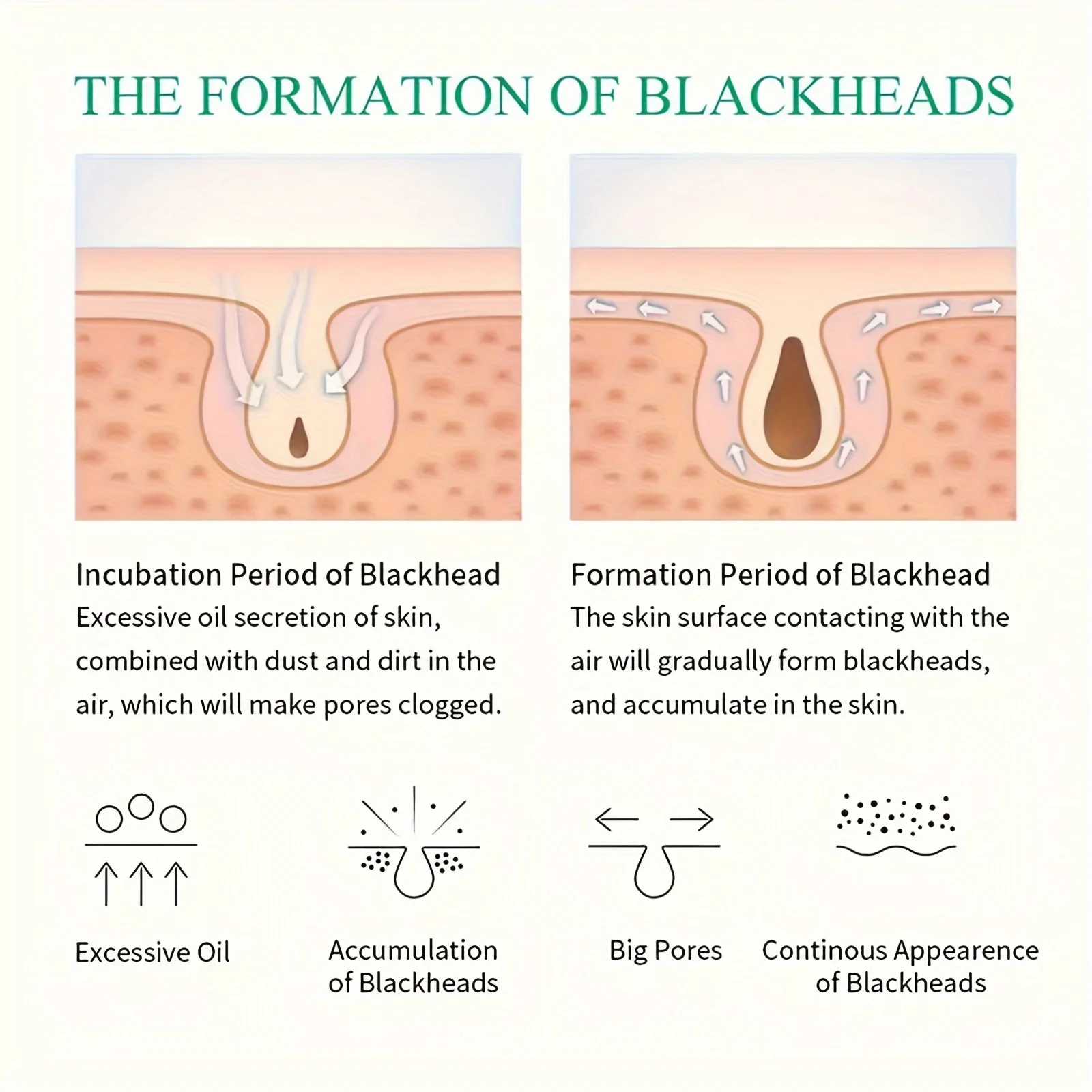 40pcs Star Pimple Patches For Face Hydrocolloid, Absorbing Cover, Tea Tree, Hydrocolloid Acne Patch, Cute Star Pimple Patch.