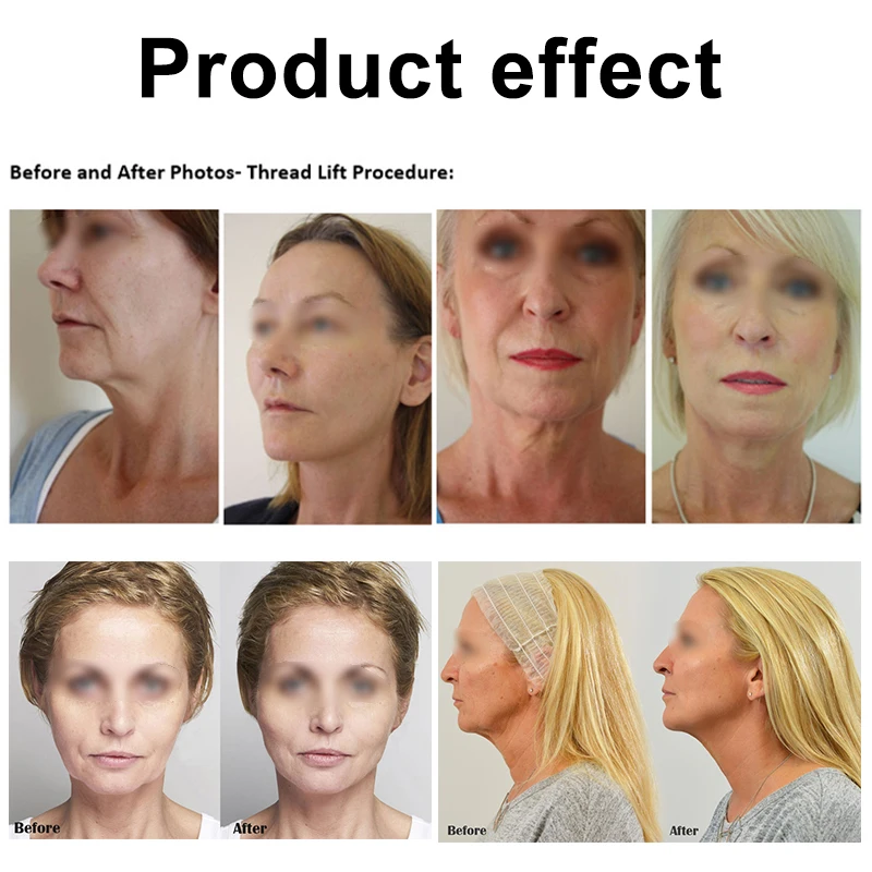 Protein Line Lifting Set Facial Repair Absorbable Collagen Essence Lifting Firming Anti-Aging Smooth Moisturizing Skin Care