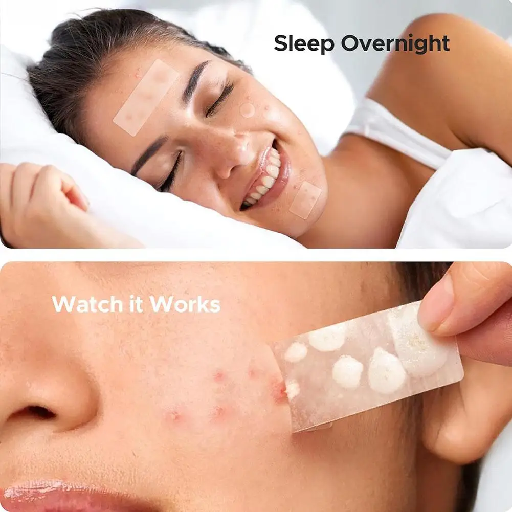 Acne Pimple Patch Invisible Waterproof Absorb Pus Acne Pimple Remover Tool Acne Cleaner Korean Skin Care Product