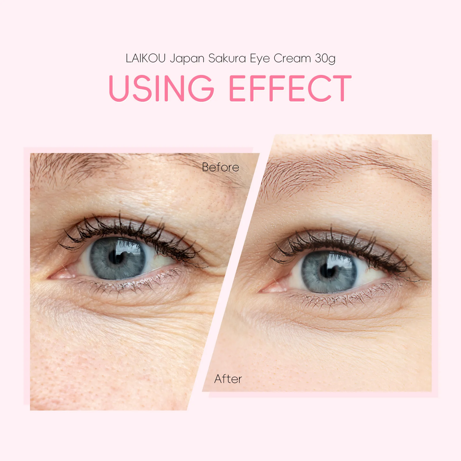 Japan Sakura Eye Cream 30g Anti Aging Dark Circle Removal Moisturizing Wrinkle Reduction Eye Treatment for Women Men Cosmetics
