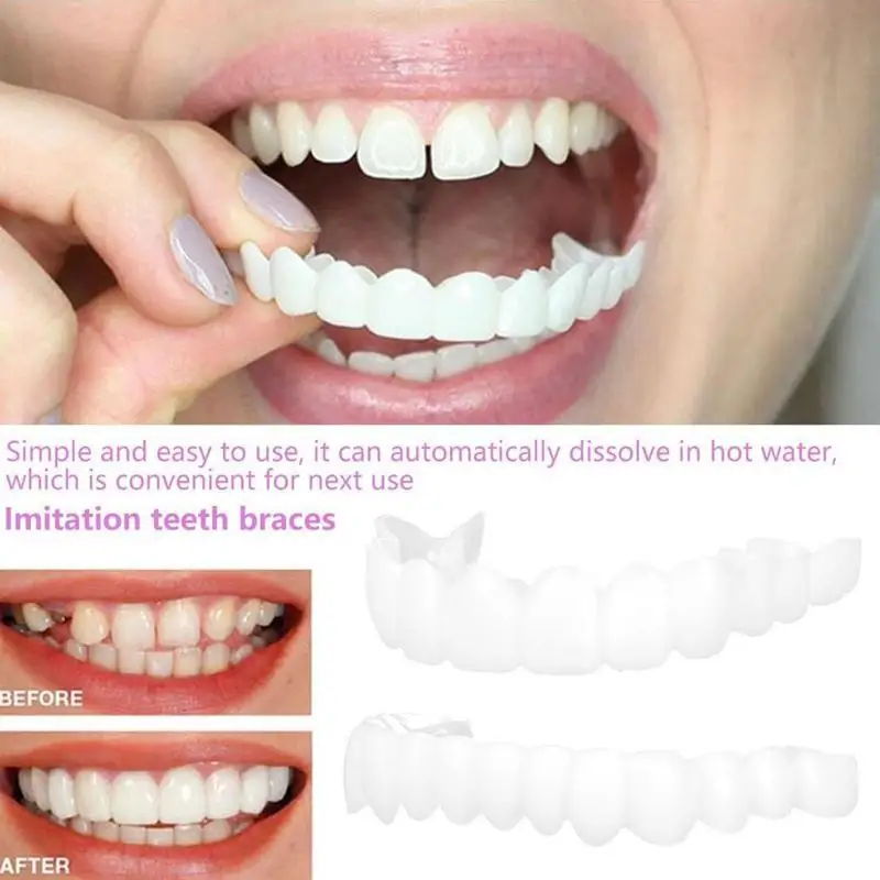 Snap On Teeth Veneers Instant Silicone Smile Veneers Teeth Upper Beauty Cosmetic Teeth Tool For Men And Women Teeth Cover